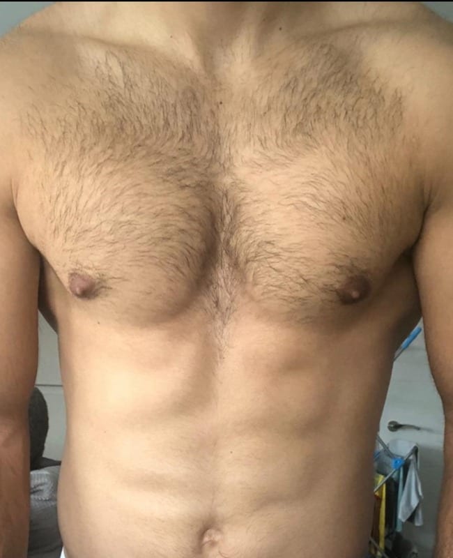 Before: Chest