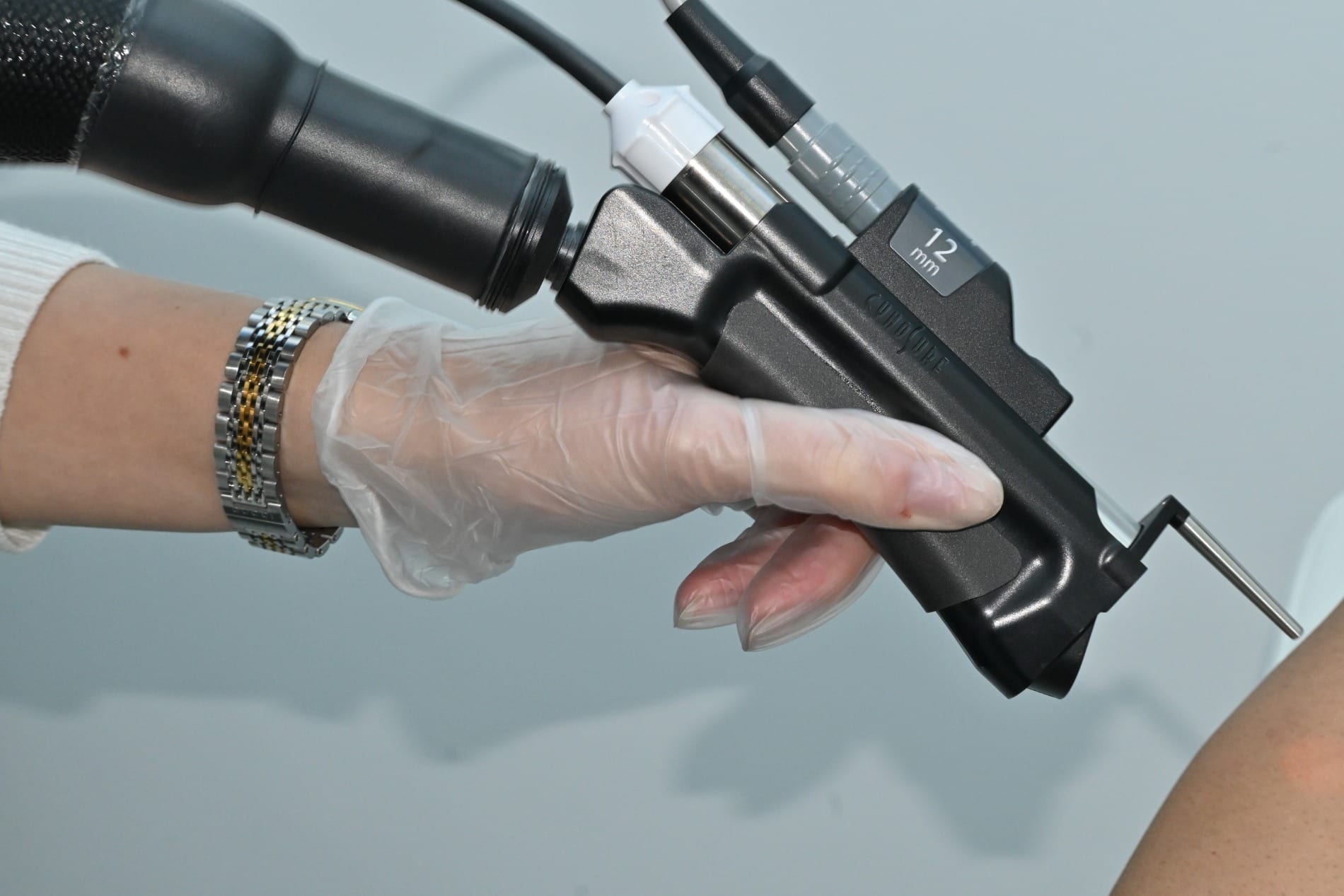 Gloved hand holding a laser handpiece during a treatment